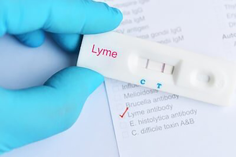 Lyme positive test result by using rapid test cassette